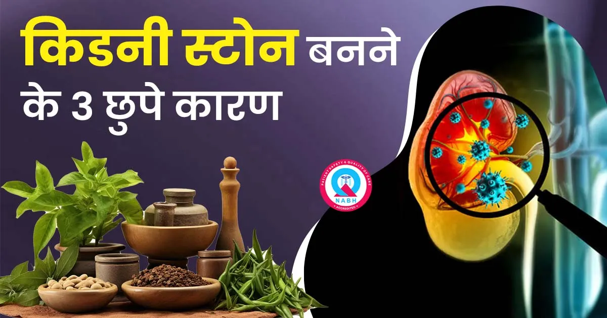 किडनी-स्टोन-बनने-के-3-छुपे-कारण